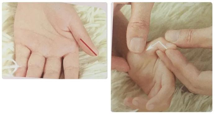 小儿腹泻怎么办？学会推拿让孩子少受罪