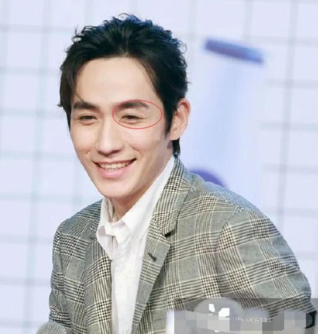 一脸褶子硬凹少年感的男星,长泽雅美和满脸褶子的男星