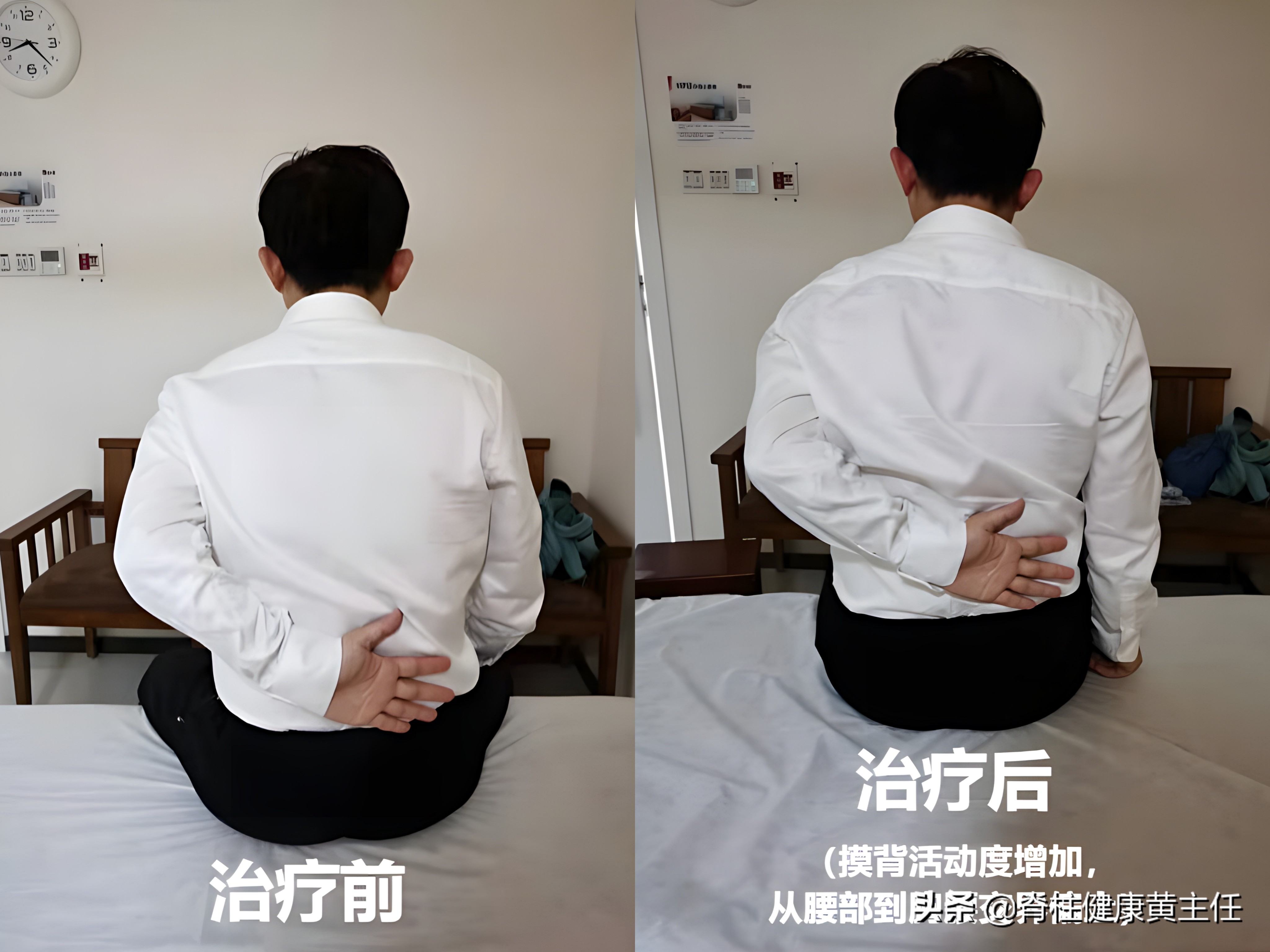 肩关节疼痛护理诊断及措施,肩关节疼痛如何查体