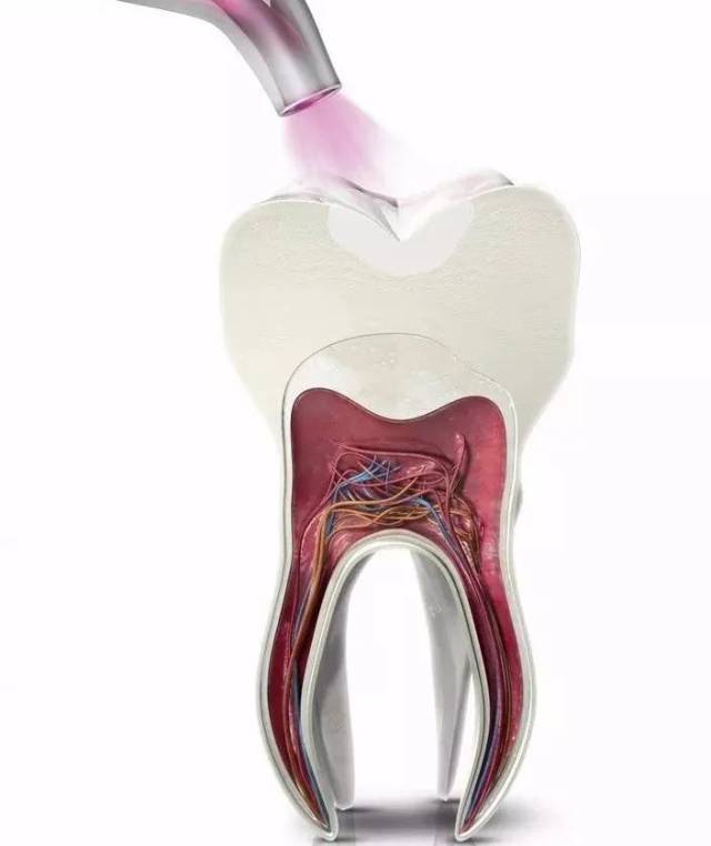 补的牙咬东西酸怎么办,补好的牙一按就疼