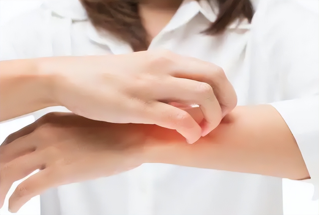 3块钱一瓶的炉甘石洗剂，连世卫组织都推荐，可以用来治哪些病？