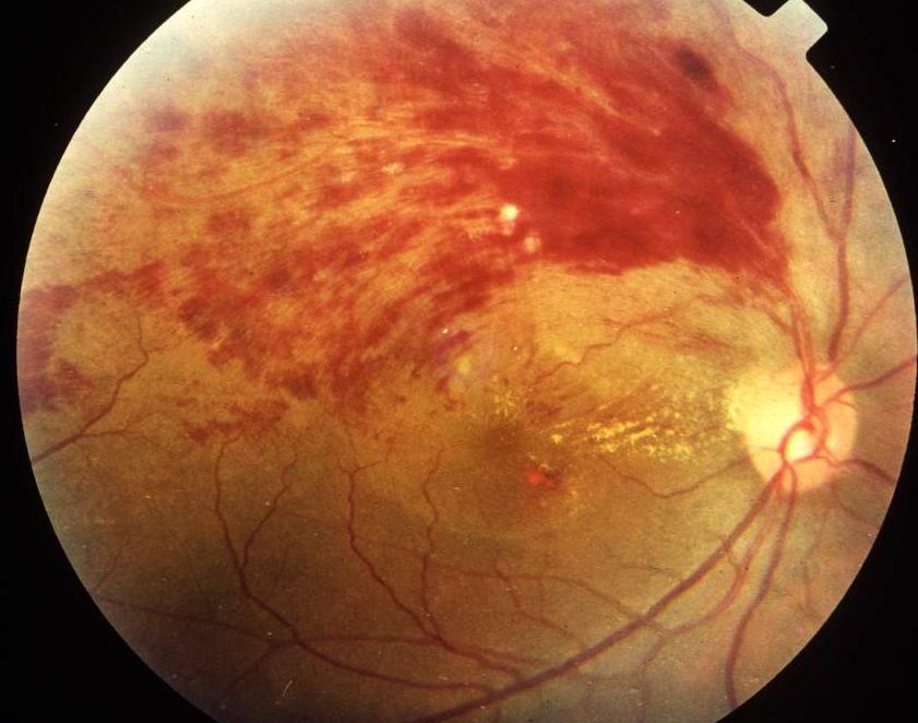 陈女士偷偷往丈夫杯子放了一颗西地那非，后来怎么样了?