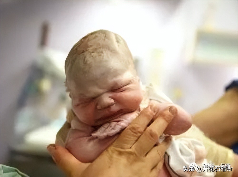 新生儿这28个异常表现都是正常的,新生儿值得注意的各种症状