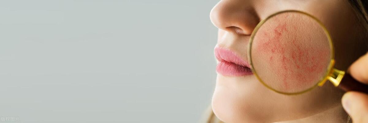 一年四季皮肤泛红怎么改善,皮肤突然泛红怎么解决