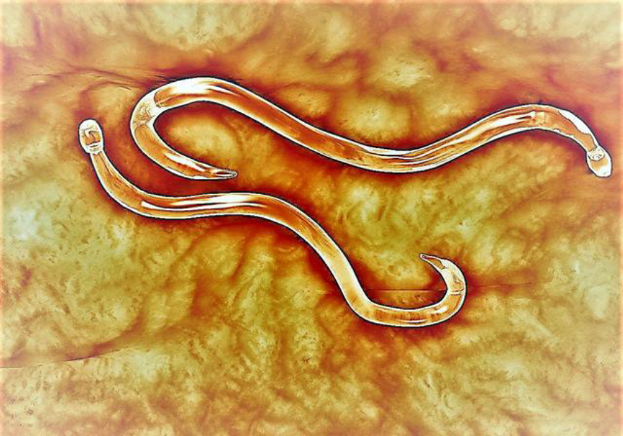 如果水蛭吸到了人物会怎么样,如果水蛭进了身体吃什么药