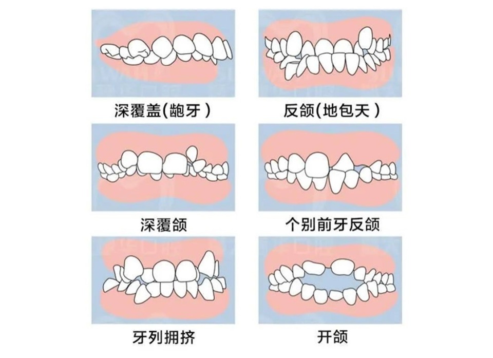 担心孩子牙长不好？青少年儿童口腔定期检查全攻略来了！