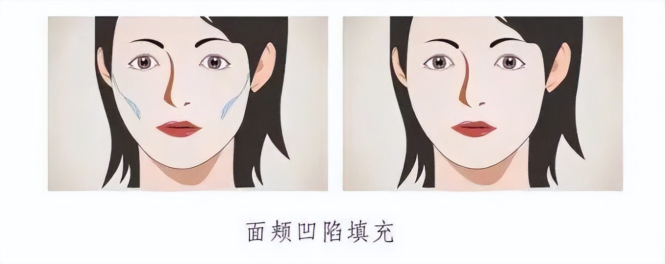 上海九院韦敏轮廓做得好吗,九院韦敏磨骨好吗