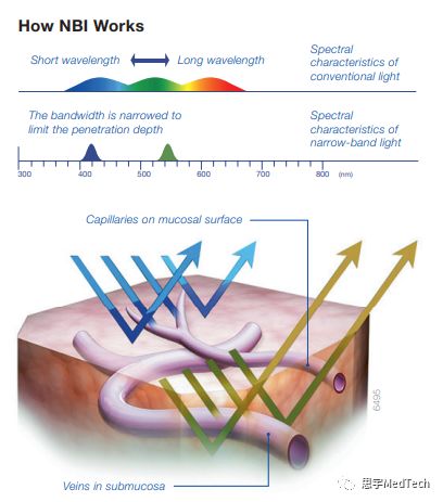 奥林巴斯的内窥镜,奥林巴斯最新款医用内窥镜