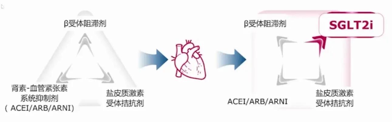 心力衰竭的最新四联疗法,心力衰竭的新四联疗法