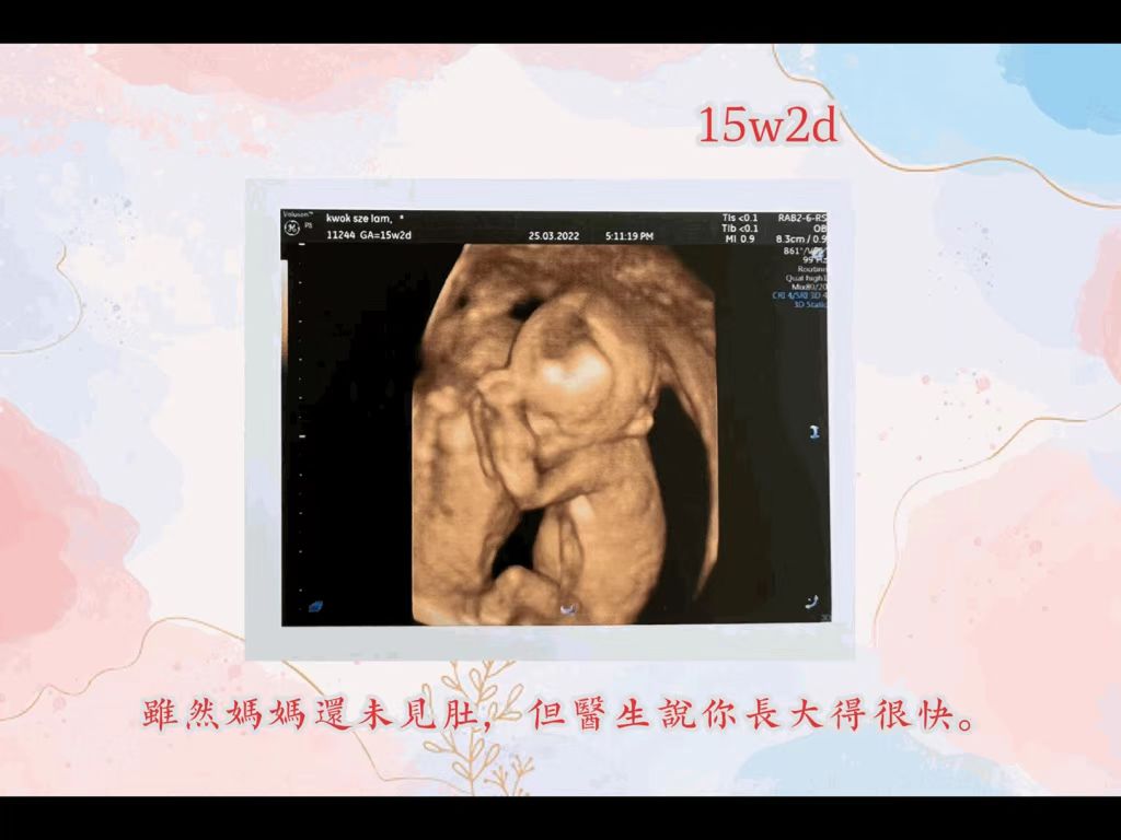 伟大母亲产子视频,伟大妈妈产下龙凤胎