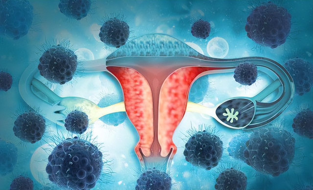 月经出现这4种异常,月经出现问题需要做哪些检查