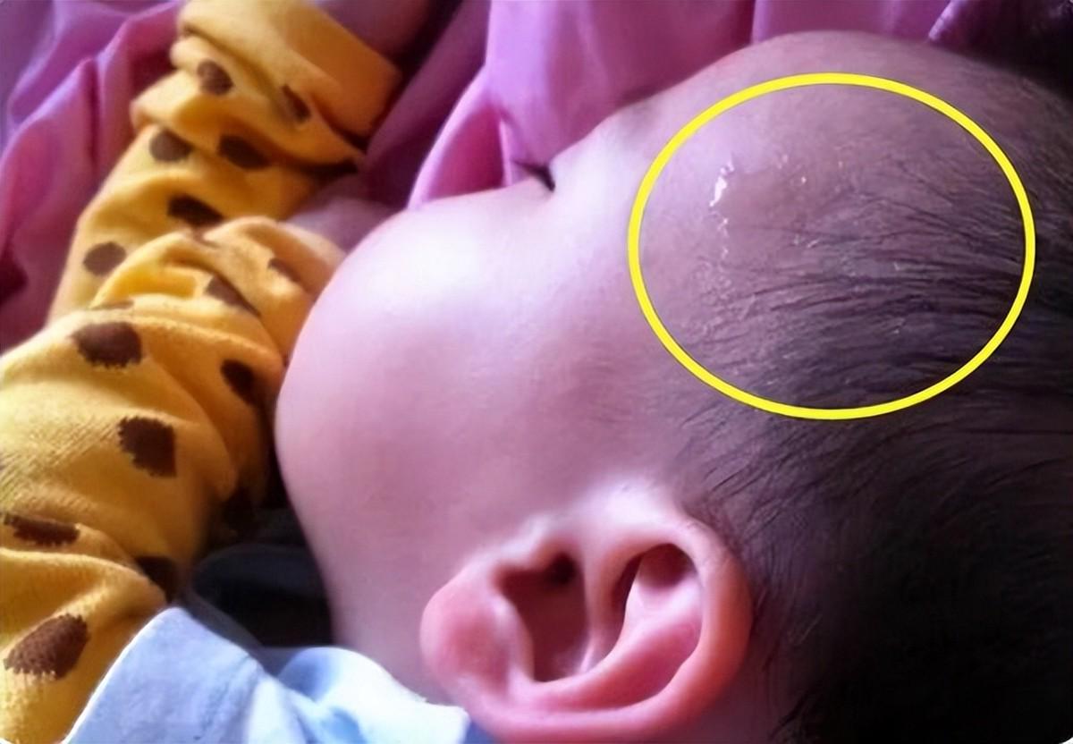 娃一到晚上就发烧出汗,娃一睡觉就出汗怎么回事