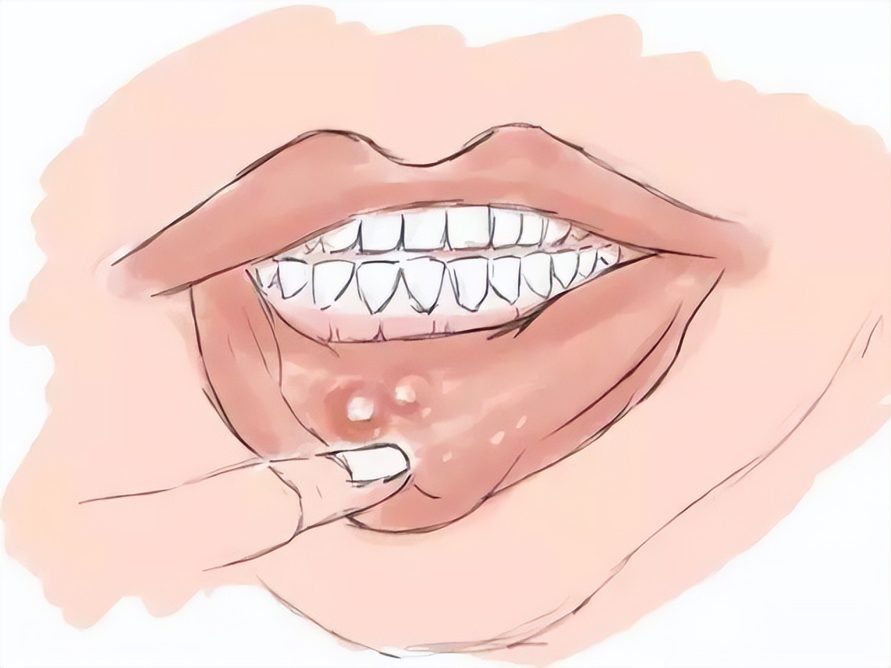 b2对高血压有哪些好处,高血压病人吃维生素b1还是b2