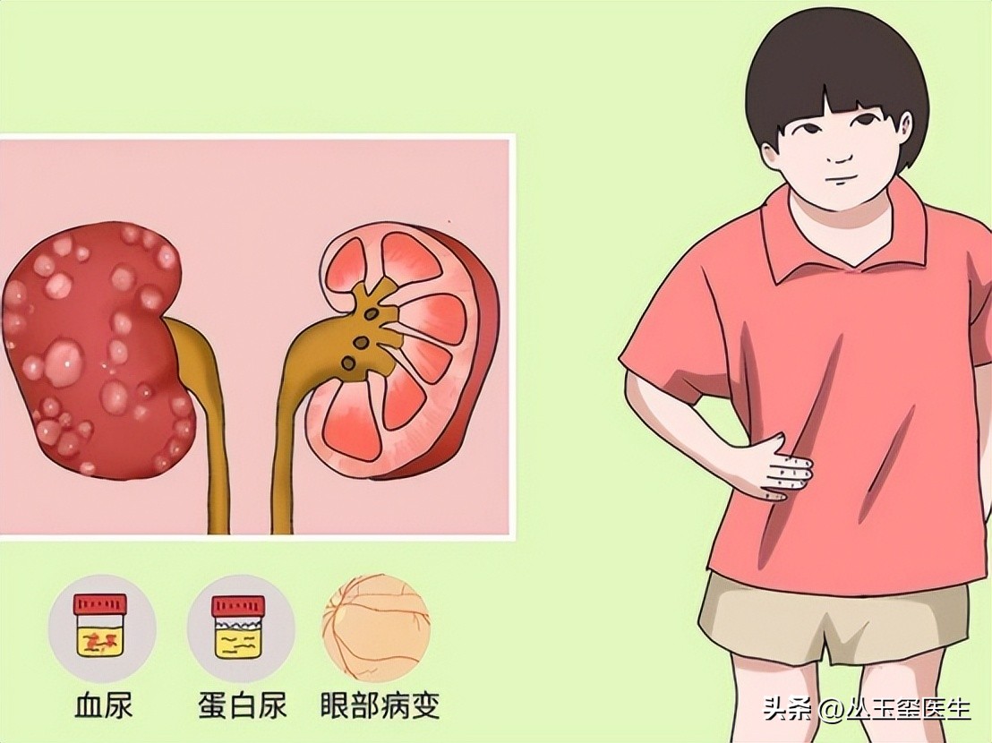 尿毒症死亡主要原因-心血管疾病，超声检查效果如何？