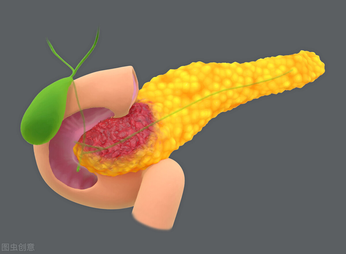 癌症免疫疗法为何对大多数人无效,癌症全身扩散有必要用免疫疗法吗