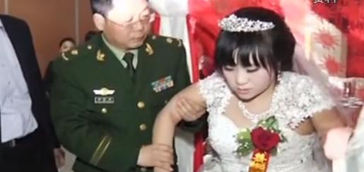 小腿巨粗的女孩,河南女子患病腿粗如大象