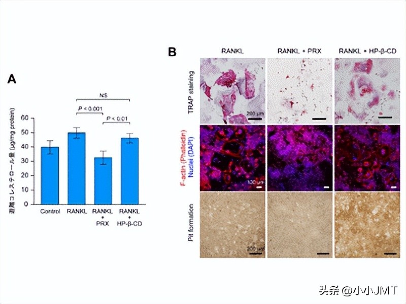 日本研制抗骨质疏松药,日本治骨质疏松的药好用吗