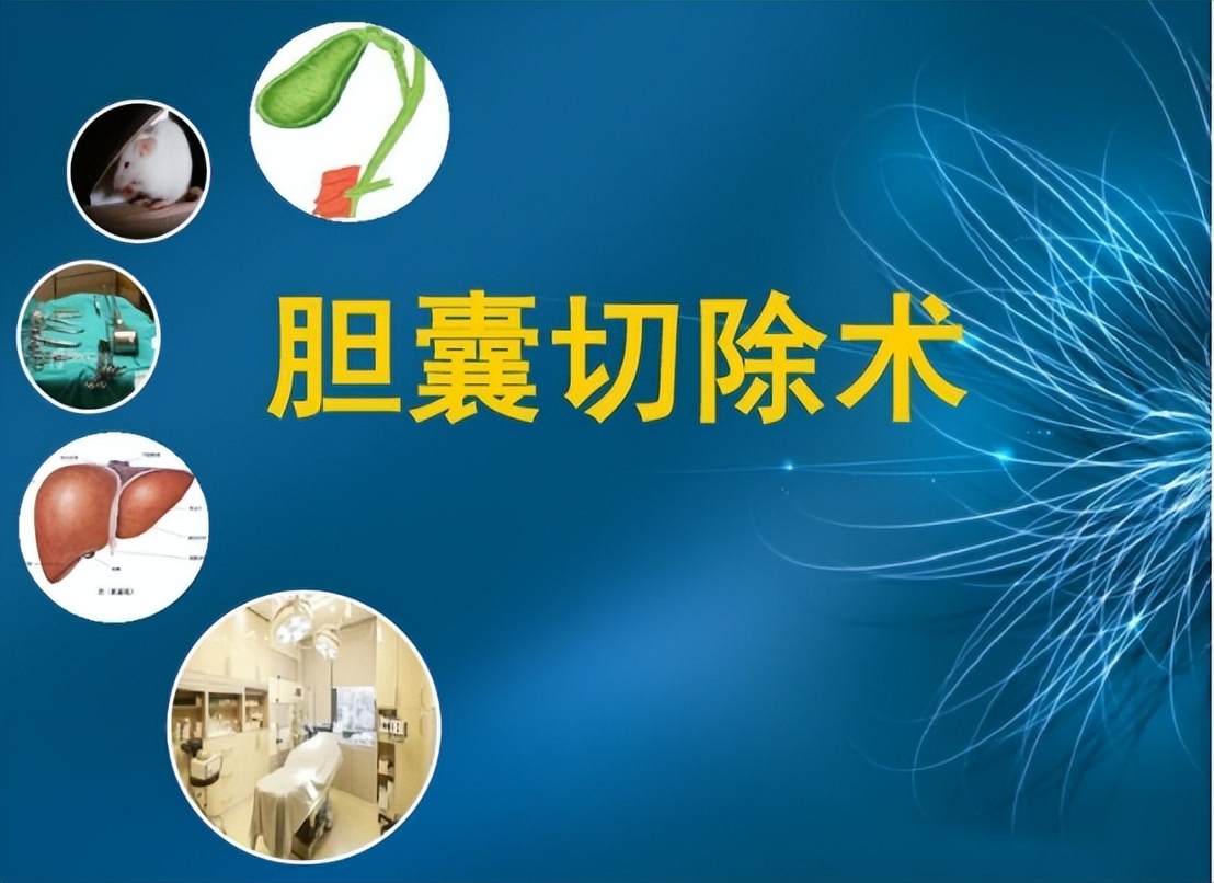 急性胆囊炎的主要治疗方法有哪些,急性胆囊炎最佳的治疗方案是什么