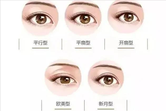 整形科普知识修复双眼皮,双眼皮整形有哪些常见方法