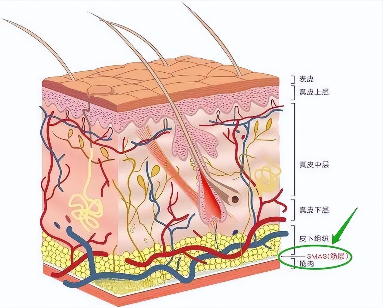 smas筋膜除皱效果怎么样,smas除皱手术需要用内窥镜吗