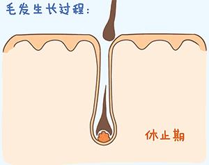 怎么解决在英国脱发,英国秃头率
