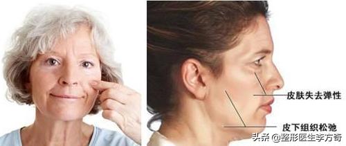 打除皱针与抗衰针有啥区别,除皱针一般哪种姿势会更好操作