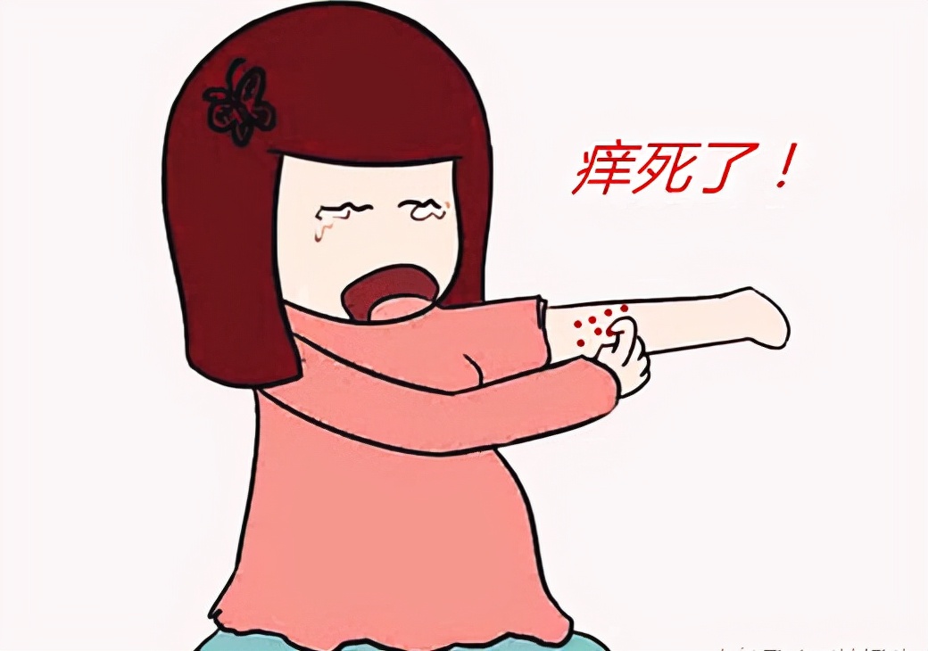 麻疹止痒最有效方法,麻疹止痒