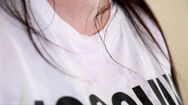 我现在出现全身湿疹怎么治,我40岁了为什么还长湿疹