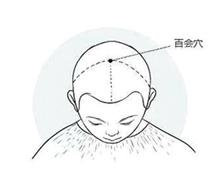 高血压先别着急吃药试试这个方子,高血压不要怕教你一招