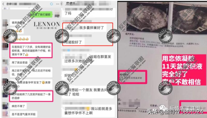 上海矗美旗下“恋侬”品牌三级代理模式涉嫌违法违规