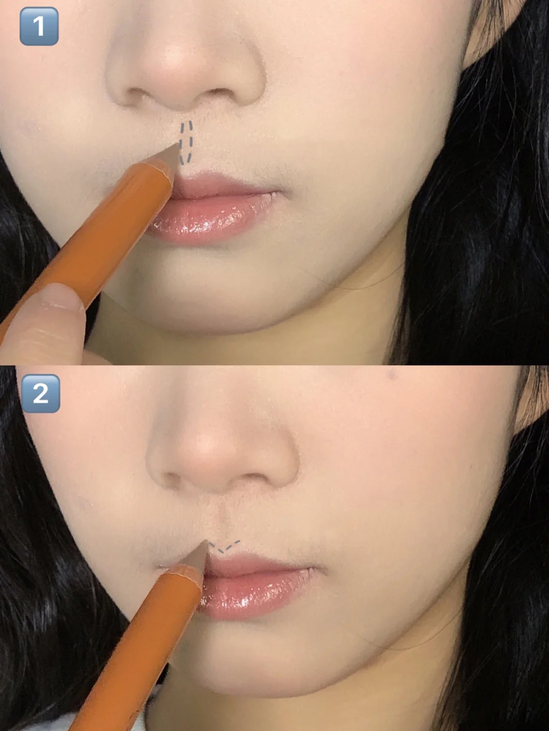 凸嘴矫正可以缩短人中吗,人中太长凸嘴怎么化妆缩短