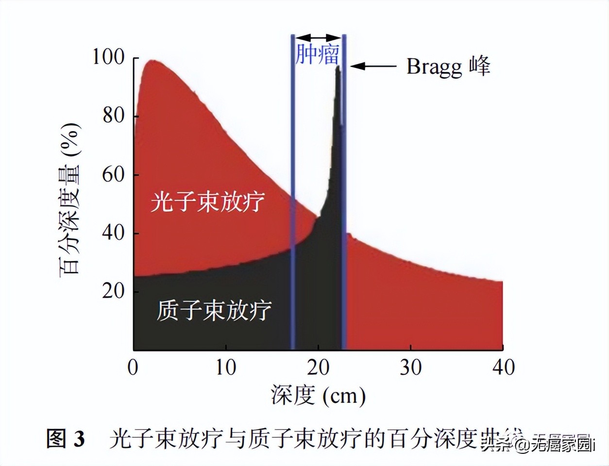 脑瘤、肺癌及儿童肿瘤等不妨考虑质子治疗,疗效和生存质量双保障