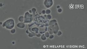 脐带血里存在大量的造血干细胞,脐带血冻存10年