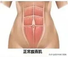 关爱产后妈妈｜帮您了解产后康复