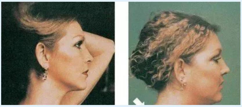 皮肤催老剂大揭秘，都帮你总结在这篇了