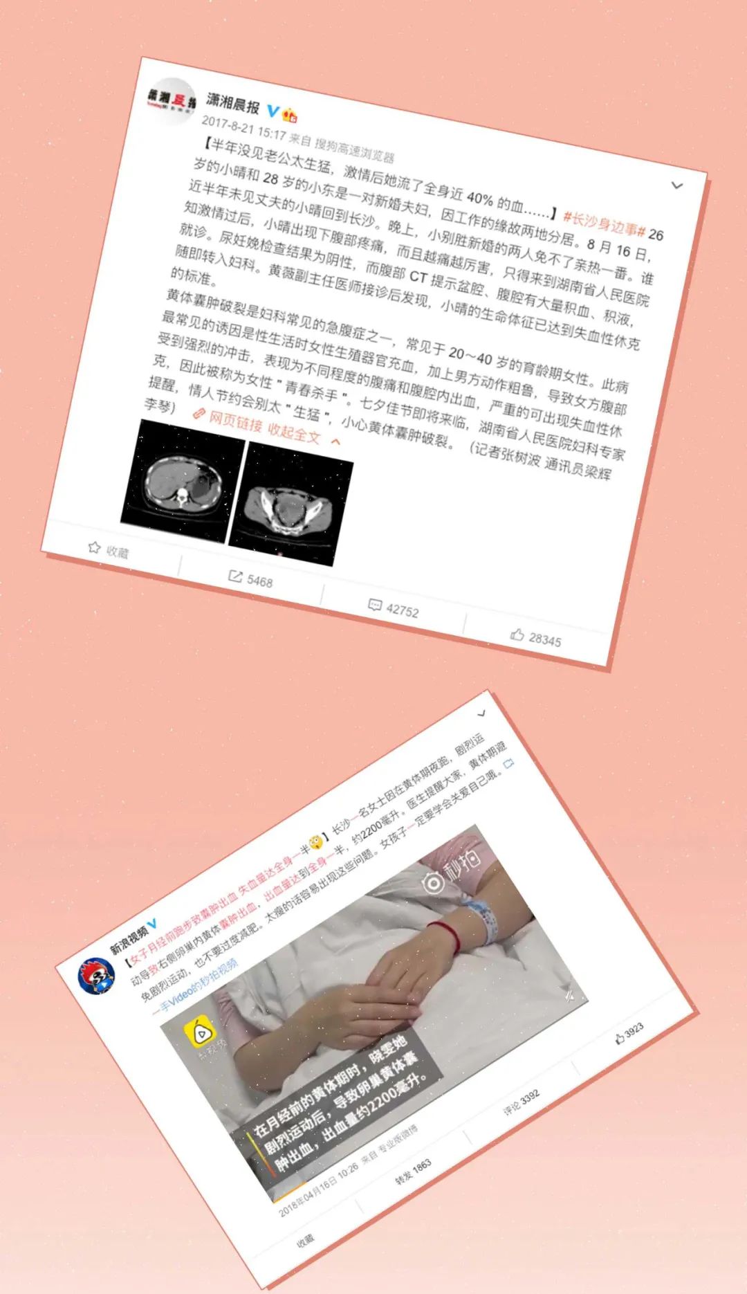 女生黄体破裂会是什么表现,什么原因会导致女性黄体破裂