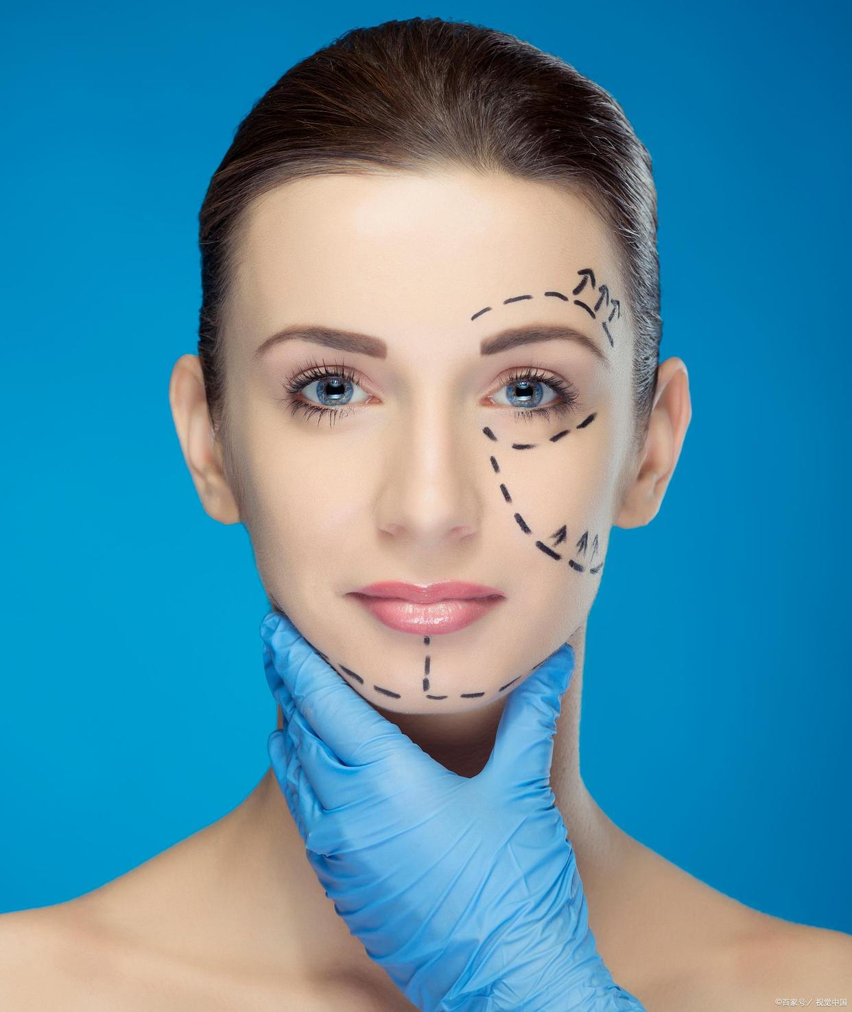 拉皮手术的6个秘密,有做过小拉皮手术的真实案例