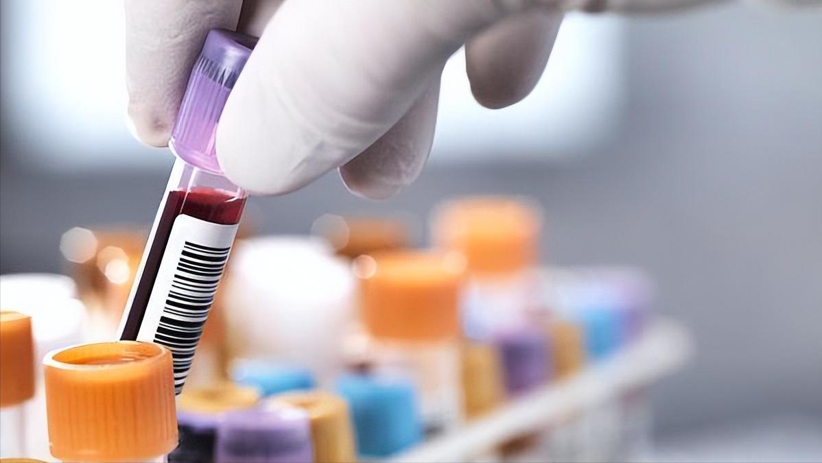 现在看病为什么动不动就要验血,医院里验血抽的血最后都去哪里了