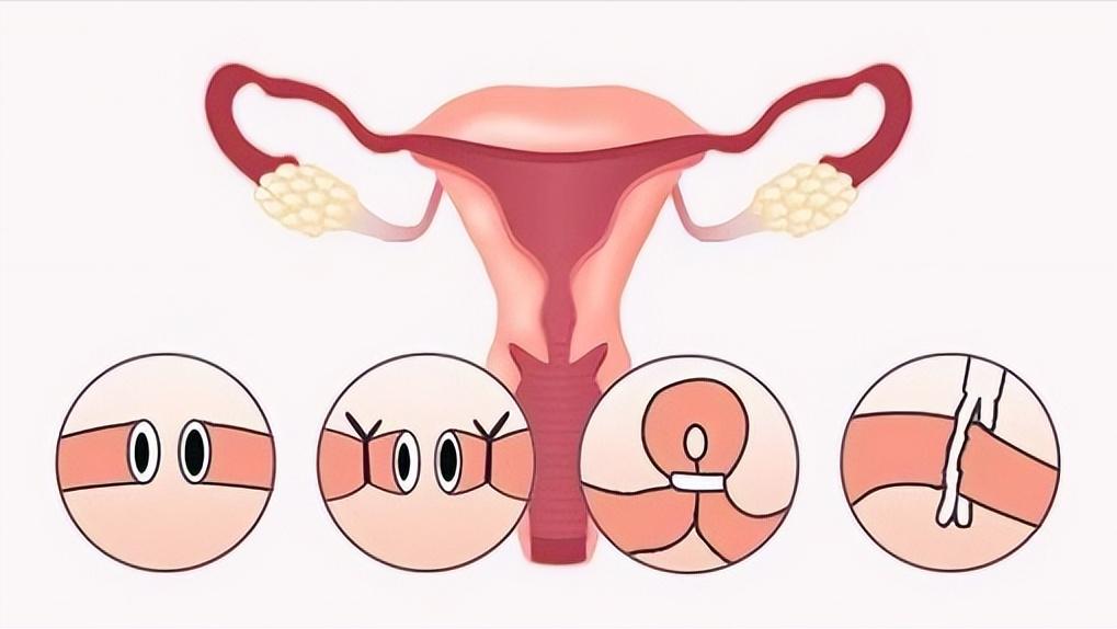中国最初的避孕方法,古人没有保险套怎么避孕