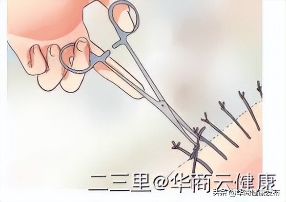 产后护理需要注意哪些坑,产后需要特别注意这两点