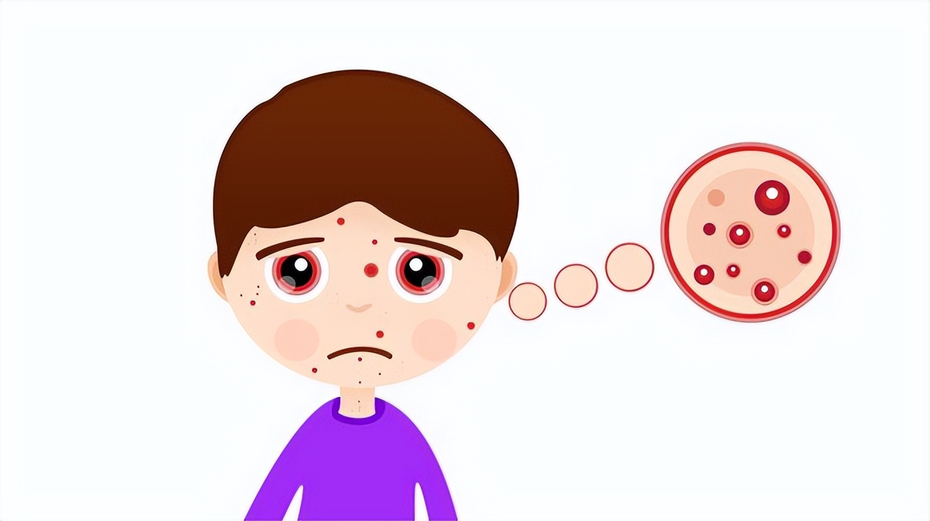 痘痘肌肤怎么形成的,痘痘肌肤问题及解决方法