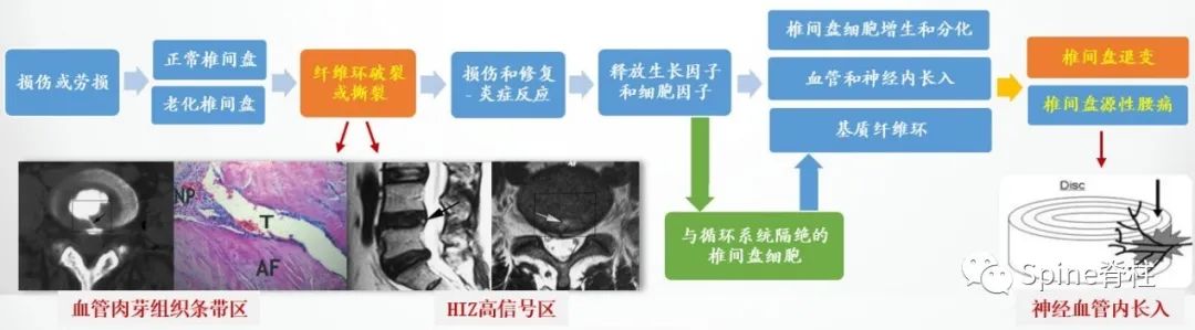 因腰椎问题导致的腰痛,慢性腰骶部疼痛