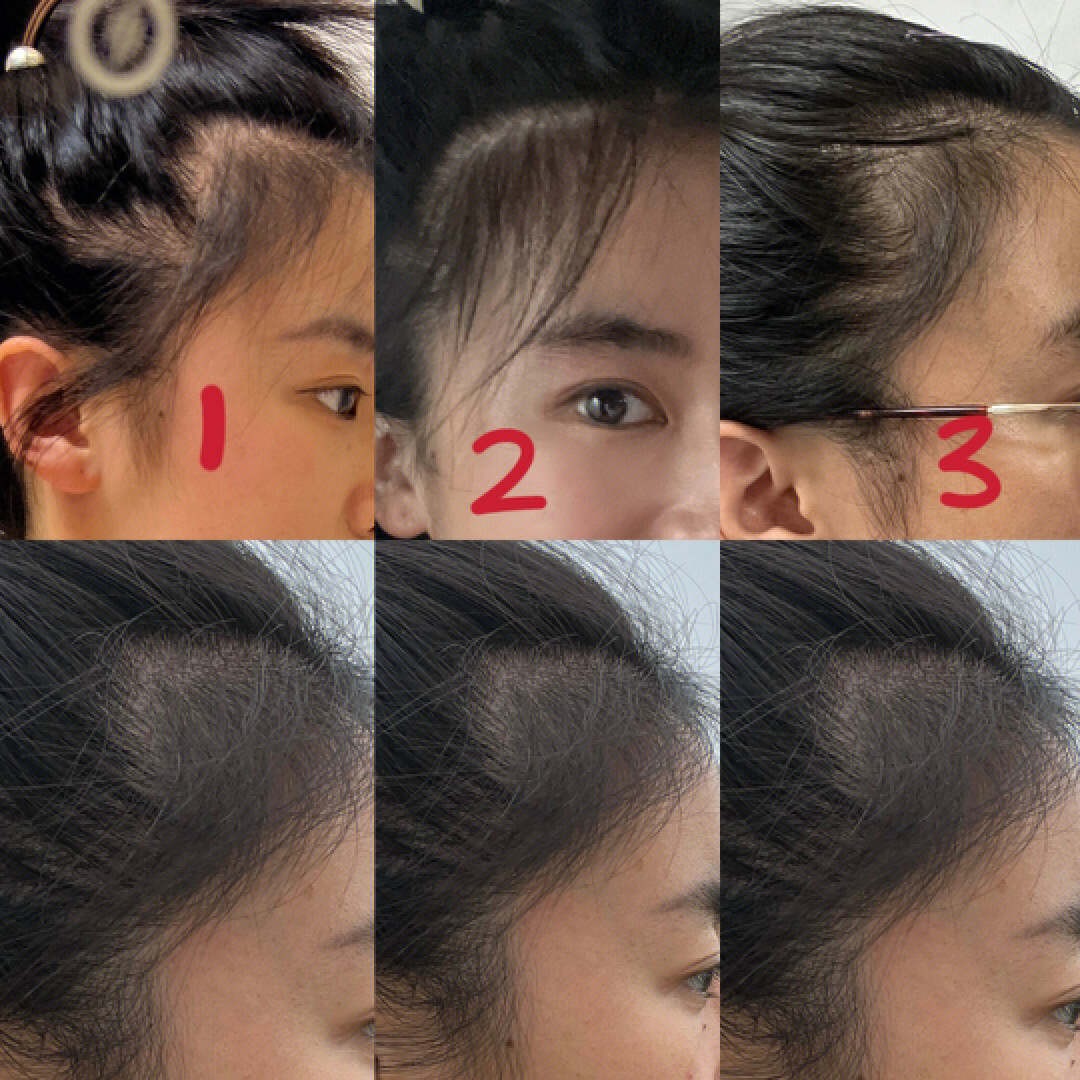 有效的防掉防脱洗发水,什么防脱洗发水适合干性头发用