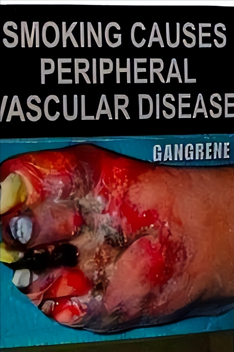 加拿大香烟对身体有害吗,加拿大香烟危害