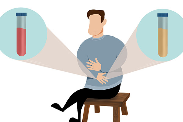 体检发现前列腺钙化灶怎么办,体检出前列腺钙化灶需要治疗吗