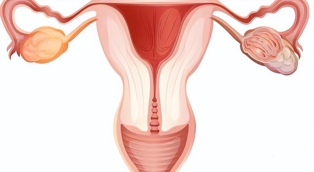 巨阴症影响生育吗,女性巨阴症的主要表现是什么