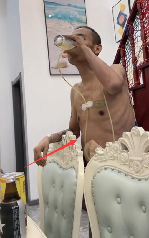 28岁抗癌网红离世,42岁网红抗癌离世