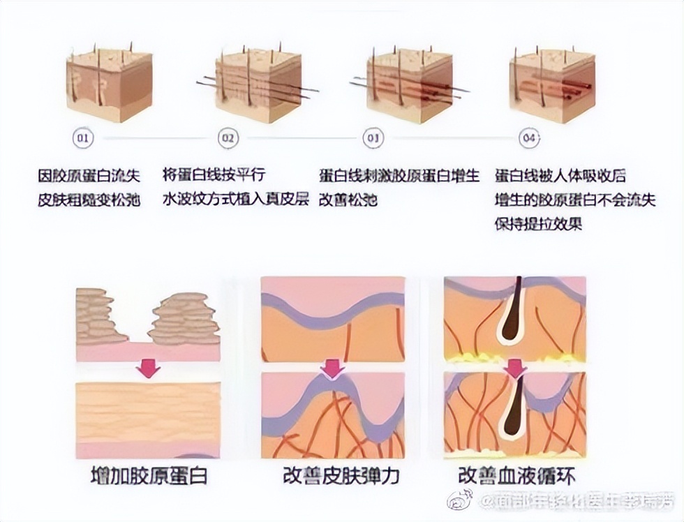 抗衰攻略项目大全,抗衰小细节详细介绍