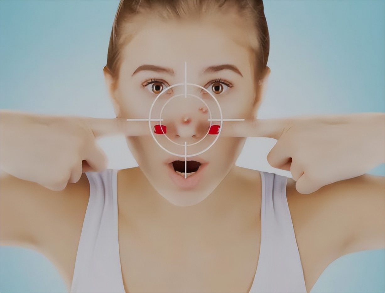 鼻子处挤出来白色物质是螨虫吗,鼻子挤出来的黄米粒是螨虫吗