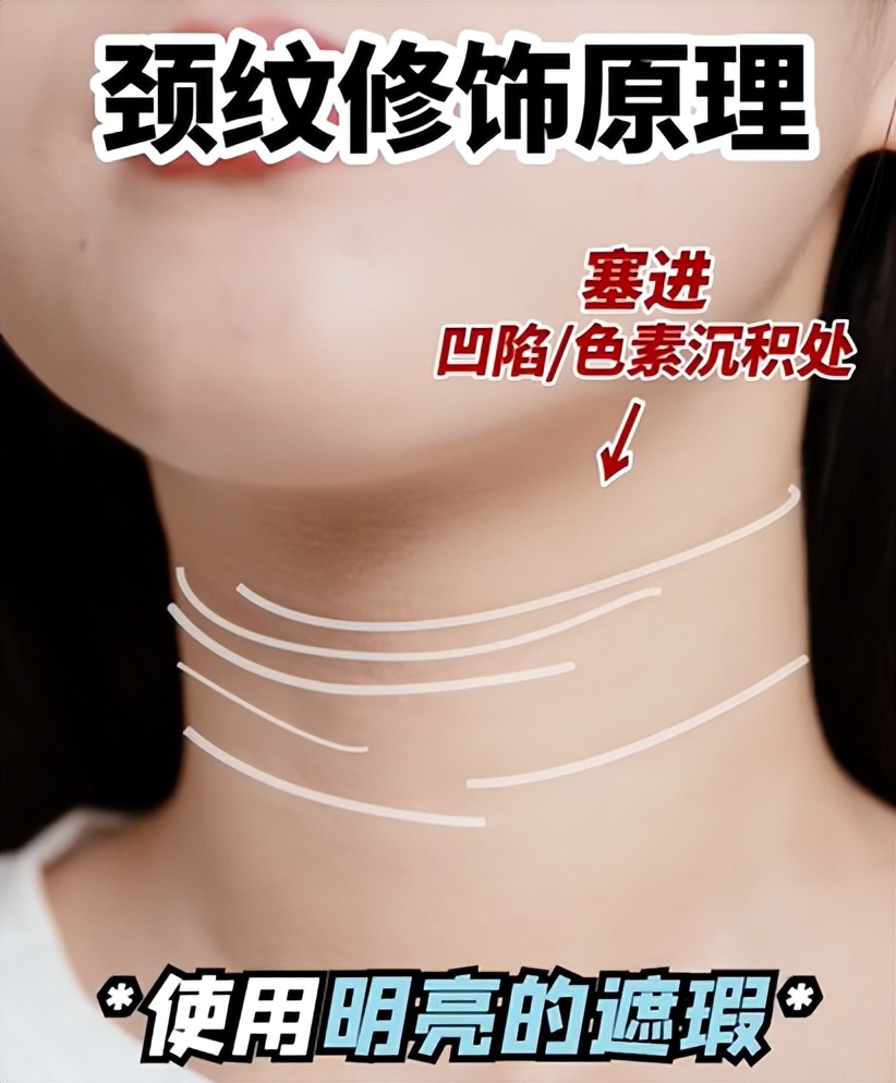 1条颈纹=显老10岁，可怕的颈纹还有救吗？
